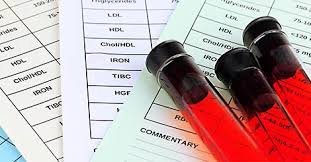 Higher Level Of Sgpt Risks Causes Symptoms Blood Test