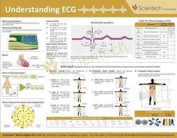 Image Result For Arrhythmia Recognition Poster Cardiac