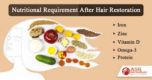 We did not find results for: Important Nutrients To Include In Your Diet After The Hair Transplant Procedure