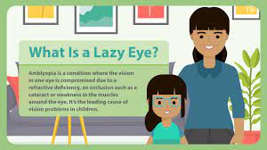 how to fix a lazy eye treatment