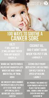 brilliant ways to soothe a canker sore