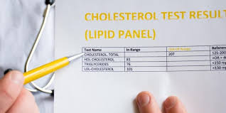 cal minute never had a lipid panel