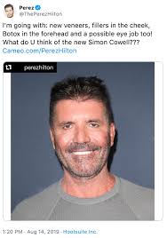 simon cowell facelift memes and