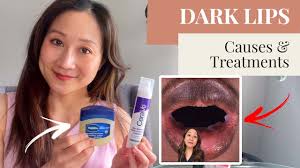 dark lips causes and treatments you