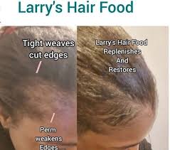 natural alopecia psoriasis treatment