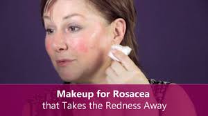 makeup for rosacea that takes the