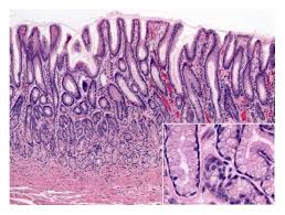 normal gastric mucosa histology a