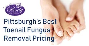 toenail fungus removal treatment body