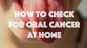 how to check for mouth cancer at home