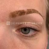 what-happens-if-you-pick-powder-brow-scab