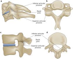 osteoarthritis of the spine the facet