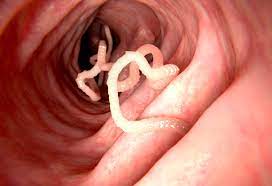 worm infection in young child reasons