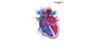 Congenital Heart Defects Facts About Atrial Septal Defects