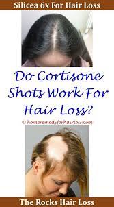 antidepressants hair loss