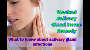 blocked salivary gland home remedy