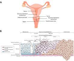 cervical cancer therapies cur