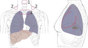 Respiratory Sounds Wikipedia