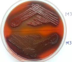 Its solubility is greater in organic solvents. Congo Red Agar Detection Of Biofilm Download Scientific Diagram