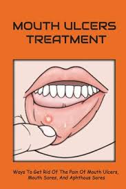 Being rich in sulfur, onions are very effective to get rid of canker sores. Mouth Ulcers Treatment Ways To Get Rid Of The Pain Of Mouth Ulcers Mouth Sores And Aphthous Sores Canker Sore In The Throat Paperback Auntie S Bookstore