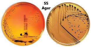 Xylose lysine desoxycholate agar (xld). Salmonella Shigella Ss Agar Culture Media Microbe Notes