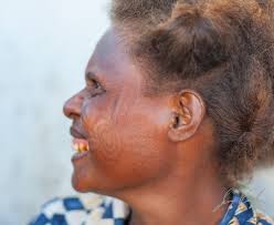But many of them have blond hair, something that has puzzled scientists for but the daily mail reports that a new study reveals the people of the solomon islands have their own gene that makes their hair blonde and it is not. Blond Haired Melanesian Woman With Facial Tattoo Sunewendelboe Com