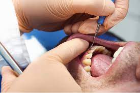 gum pain around a dental bridge suggest