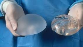 Image result for breast implants and cremation
