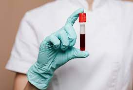 Hemofilia: investigación científica y tratamientos efectivos » CAEME