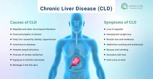 chronic liver disease cld causes