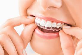 Maybe you would like to learn more about one of these? Does Dental Insurance Cover Orthodontic Care Rmhp Blog