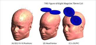 eeg electrodes positions on the scalp