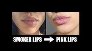 lighten dark smoker lips fast you