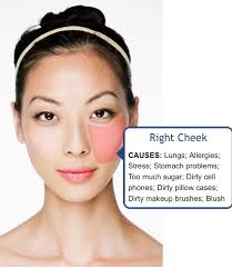 face mapping acne what is your acne
