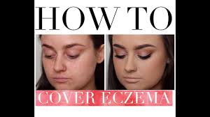 how to cover eczema updated makeup