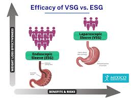 vsg vs esg traditional gastric sleeve