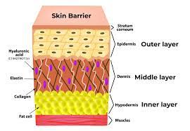 what is the skin barrier midwest