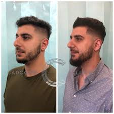 Maybe you would like to learn more about one of these? Rhinoplasty London Nose Job Nose Reshaping Surgery Cadogan Clinic