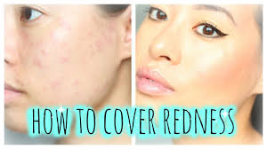 how to cover redness allergic