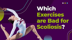 4 scoliosis exercises that can help