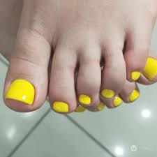 yellow toenails 92 photos of works
