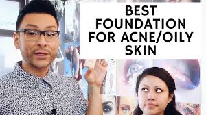 for acne e oily skin