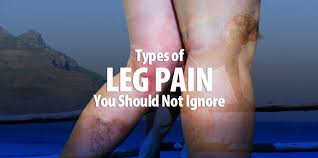 types of leg pain you shouldn t ignore