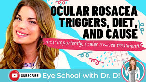 ocular rosacea treatment triggers