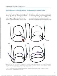 pdf suture treatment for pincer nail