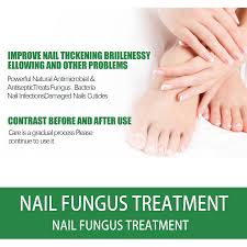 toenail fungus treatment extra