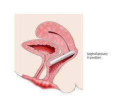 non surgical treatments for prolapse