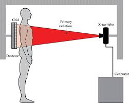 projection x ray imaging radiology key