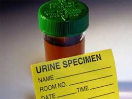 What Does Your Urine Colour Indicate Times Of India
