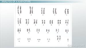 In the human karyotyping gizmo, you will make karyotypes for five individuals. Karyotype Definition Disorders Analysis Biology Class Video Study Com