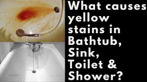 yellow stains in bathtub sink toilet